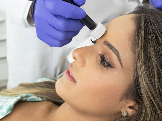 charlotte microneedling