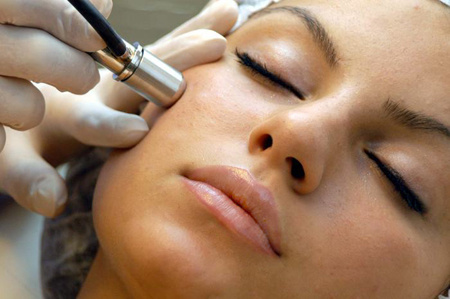 charlotte microdermabrasion facial