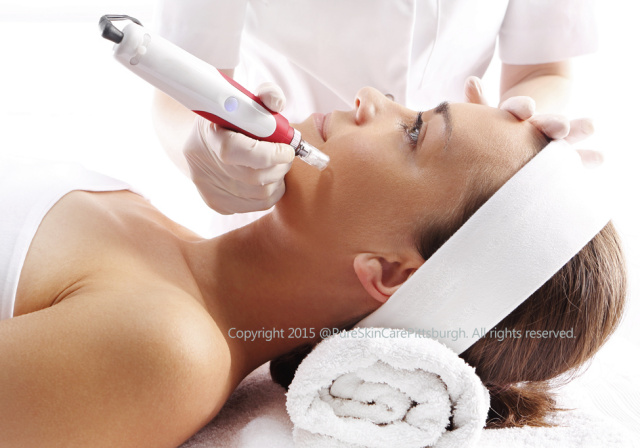 micro-needling scar pittsburgh, robinson township microneedling